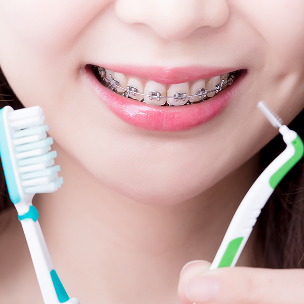 Se brosser les dents avec un appareil dentaire